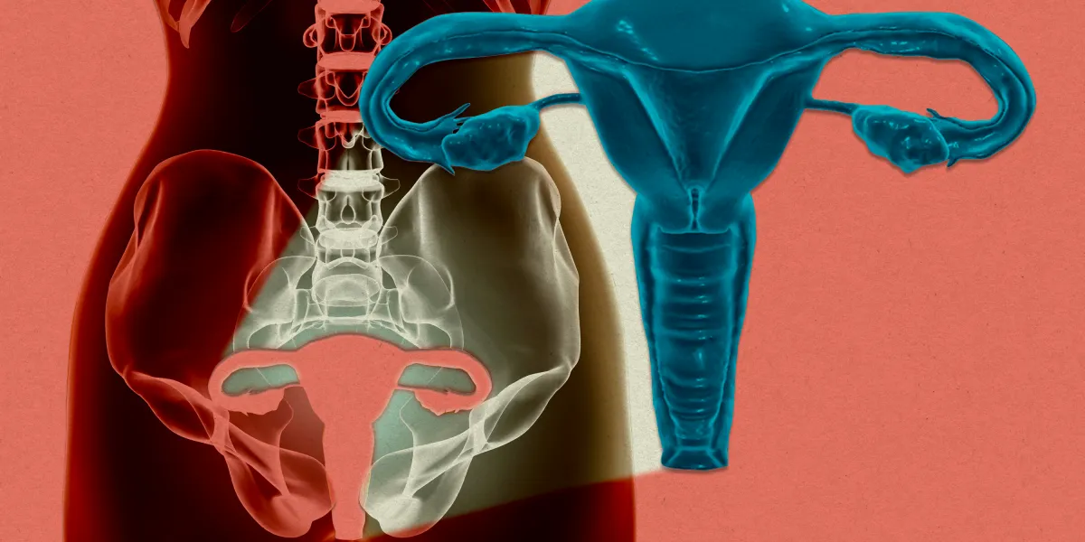 全球首例！女性子宫体外成功存活